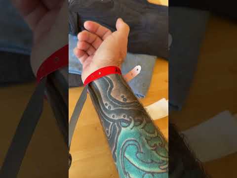 The King Battle gets the honor of cutting the surgery bands off today  