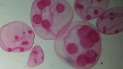 Volvox under the microscope