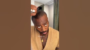 Thumbnail of STOP Hair Loss and Get INSTANT Results with Toppik Hair Fibers!