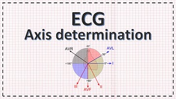 Cardiac Axis Determination | ECG Axis | Simplified