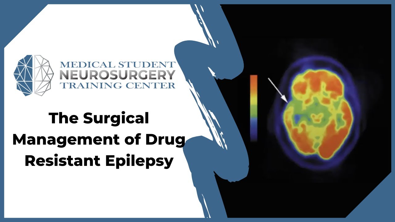 The Surgical Management of Drug Resistant Epilepsy - YouTube