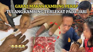 Tulang Kambing Perap Terlekat Pada Jari K4N4K2 Terpaksa Minta Bantuan Bomba