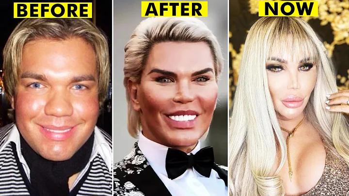 20 People Who Had Extreme Plastic Surgery - DayDayNews