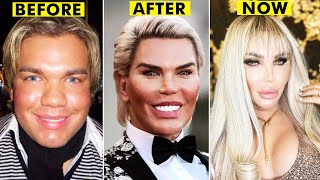 20 People Who Had Extreme Plastic Surgery