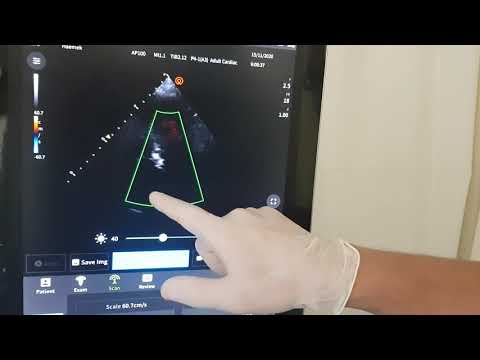 Murmur Investigation 1