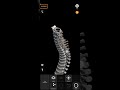 Boʻyin umurtqalari  #Vertebra Cervicalis