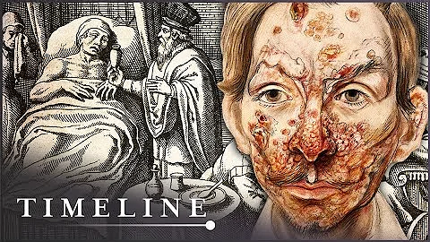 The True Terrors Of Tudor Medicine | Hidden Killers | Timeline - DayDayNews