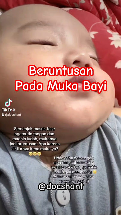 Beruntusan pada muka bayi, apa penyebabnya? #baby #bayi #infokesehatan #kesehatan #kesehatanbayi