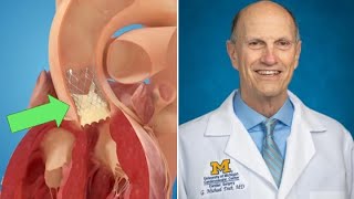 5 Must-Know Facts About TAVR for Aortic Valve Patients