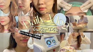 Daily Vlog | บันทึก 7 วัน ทำ PICO laser ที่กังนัม 999-. ปังหรือพัง เห็นผลจริงไหม?