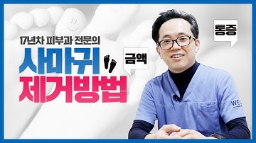 사마귀, 다양한 시술 방법과 방치하면 안되는 이유!