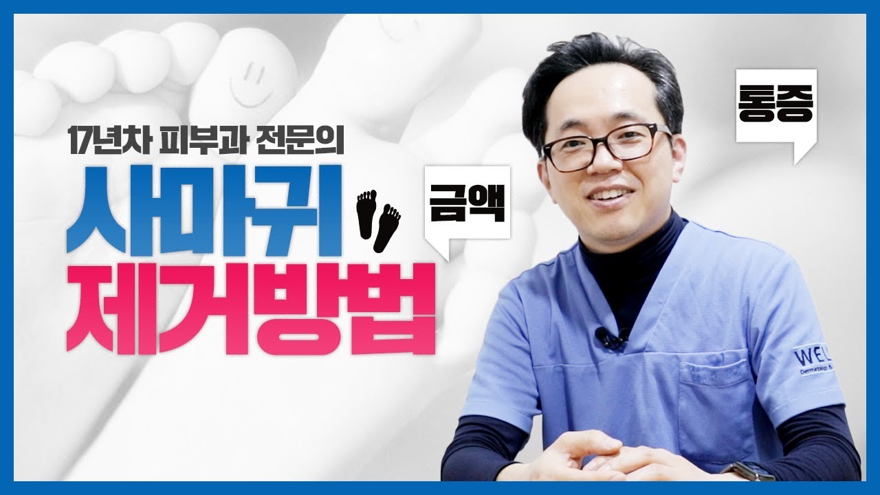 사마귀, 다양한 시술 방법과 방치하면 안되는 이유!