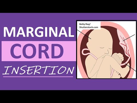 Video: Kokioje Tanner stadijoje vyksta menstruacijos?