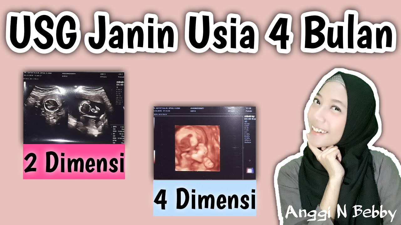 USG 4 DIMENSI USIA KEHAMILAN 4 BULAN YouTube