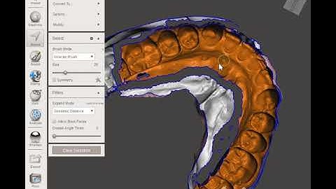 Inverting a Dental Impression Scan in Meshmixer