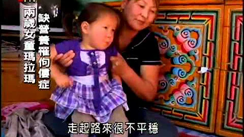 蒙古医疗资源缺乏 台湾伸援手－民视新闻 - 天天要闻