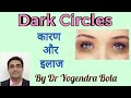 Dark circles   around  eyes   causes  treatment   by      dr  yogendra bola