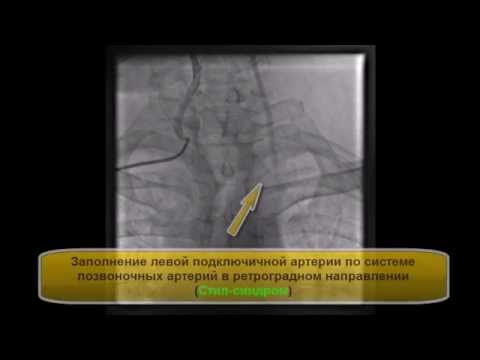 Video: Ultrasound Angiology