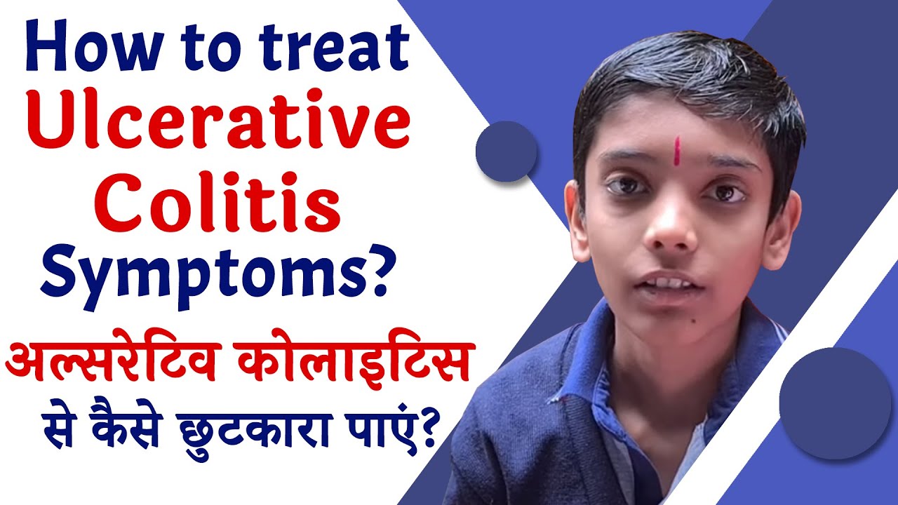 How to treat Ulcerative colitis Symptoms? | अल्सरेटिव कोलाइटिस से कैसे