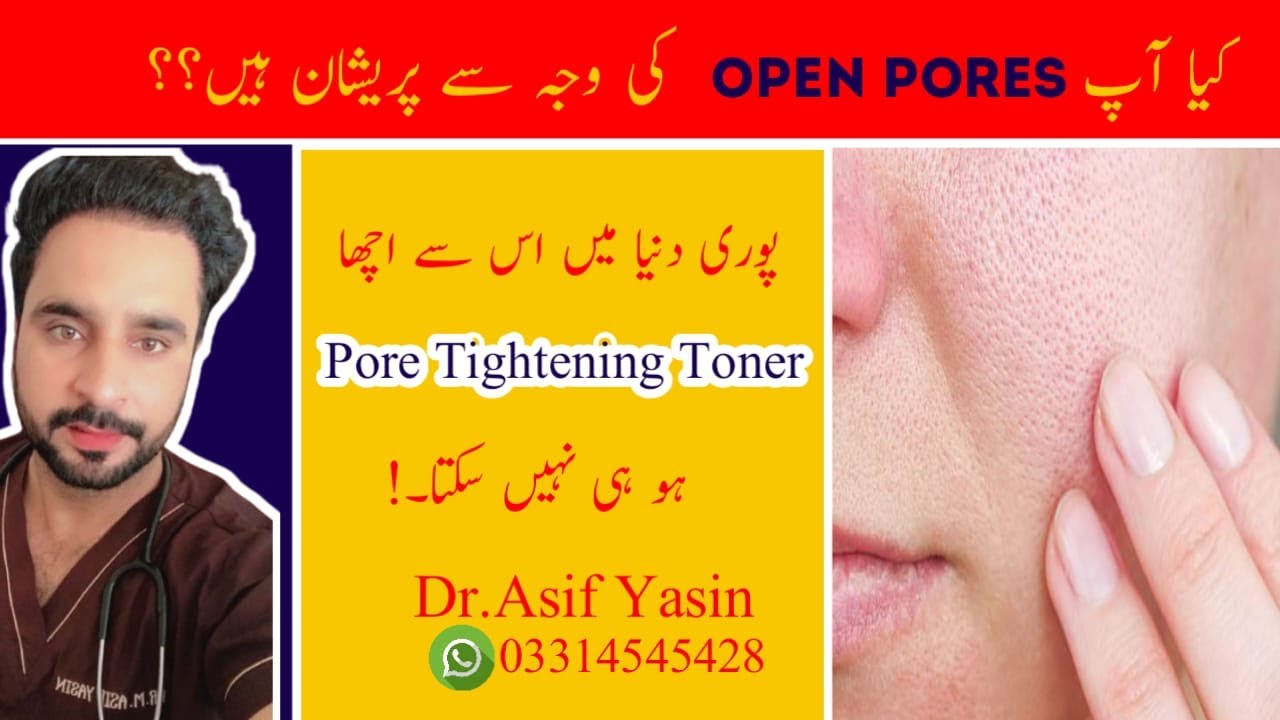Large Open Pores On Face Treatment Open Pores Khatam Karne Ki Home
