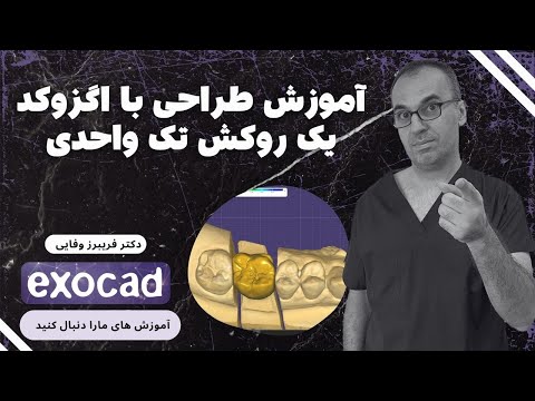 طراحی یک روکش یک واحدی