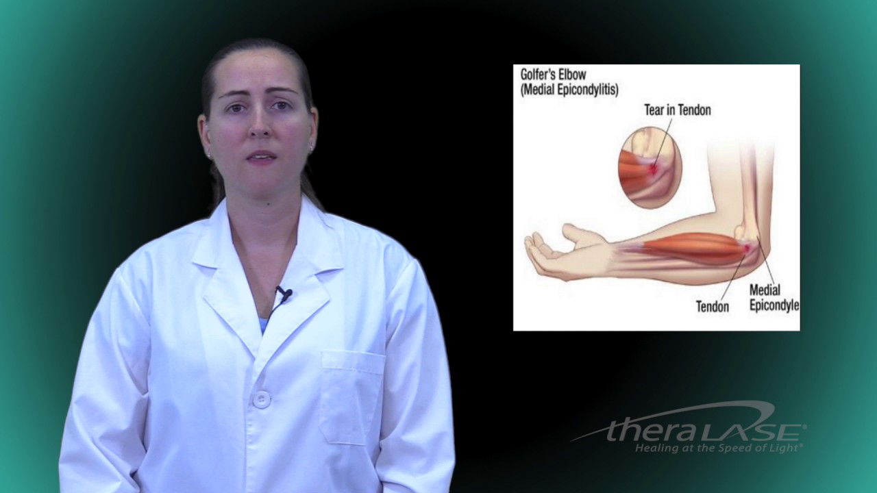 Medial Epicondylitis Theralase Educational Series TLC2000 YouTube