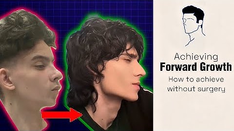 Here’s How to achieve forward growth and be attractive