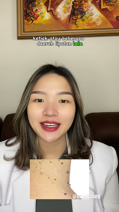 SKINTAGS ON THE NECK CAN'T BE REMOVED? #skintags #skincaretips #aestheticdoctor #skincare