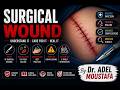 Surgical Wound _ GENERAL SURGERY_ nursing _MU