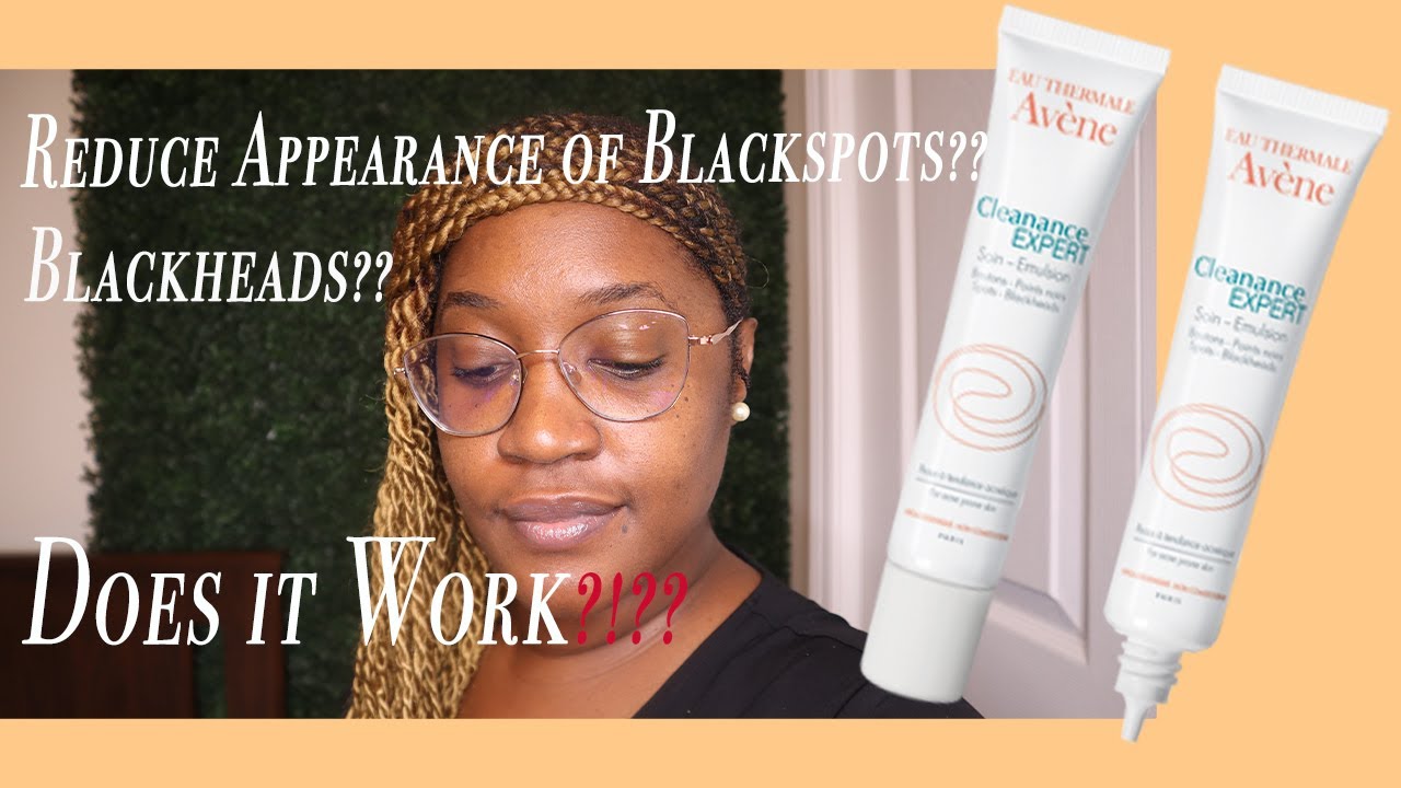 Black Spot/ Blackhead Cream - Avene Cleanance Expert!! Does it