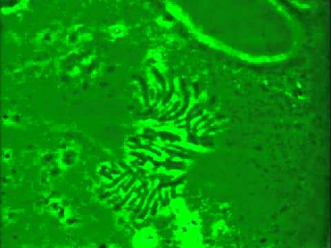 Video: ¿Cómo se ve la anafase bajo un microscopio?