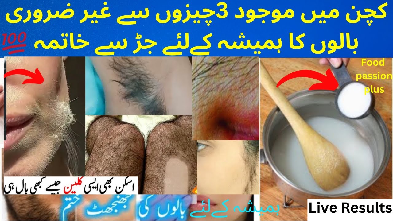 Remove Unwanted Hair Permanently at Home || Facial Hair Removal ...