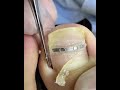 Satisfying Pedicure Routine | Gentle Toenail Care #fypシ #fypシ #pedicure #nailcare