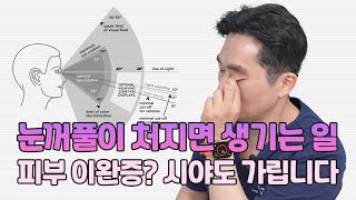 피부 이완증, 시야 가리고 주름 만든다?! 중년 남성 쌍꺼풀 수술이 늘어난 이유
