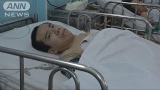ベトナムのドクさん　4回の手術が無事成功(17/05/13)