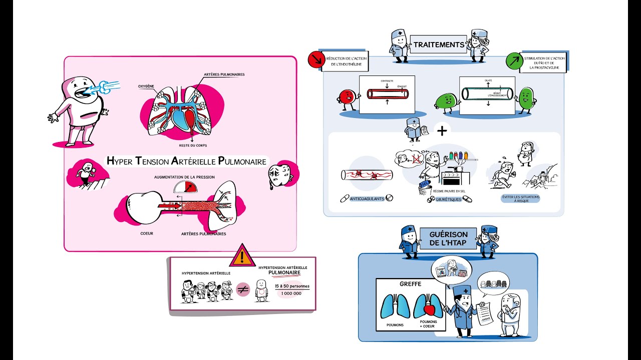 L'HTAP, qu'est-ce que c'est?