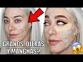 CÓMO CUBRIR ACNÉ CON MAQUILLAJE  PASO A PASO | Rutina de maquillaje para pieles con imperfecciones