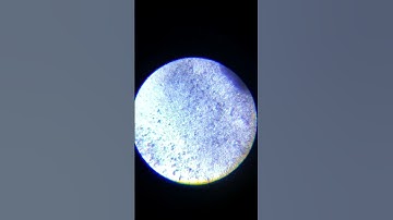 Yeast in sugar water under a microscope