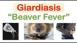 Giardiasis (Beaver Fever) Infection Sources, Pathophysiology, Signs & Symptoms, Diagnosis, Treatment