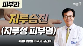 지루습진(지루성 피부염) / 서울대학교병원 피부과 정진…