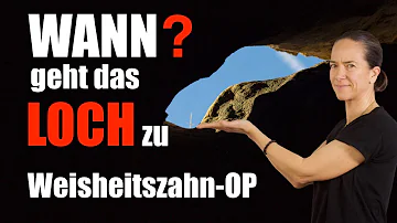 Was passiert mit Loch nach Weisheitszahn-OP?