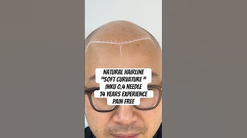 What to expect after first session             #scalpmicropigmentation