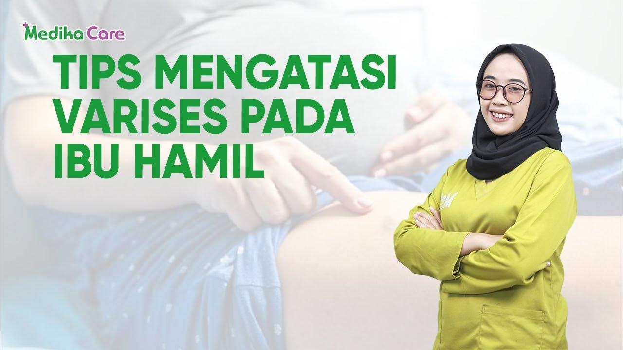 Tips Mengatasi Varises Pada Ibu Hamil || Bidan Adinda, Amd, Keb
