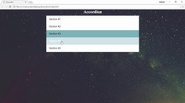Speed Code - Accordion  - HTML | CSS | JS