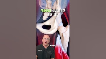 Most PAINFUL Athlete Injury? Proximal Hamstrings Tears