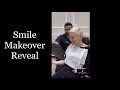 6 month Smile Makeover Reveal