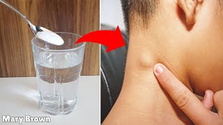 Home Remedies for Swollen Lymph Nodes