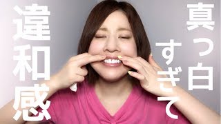自宅で簡単！確実に歯が白くなる方法