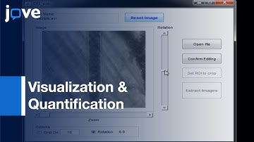 Visualization & Quantification Of Cell-free Layer-Arterioles:Rat Cremaster Muscle l Protocol Preview