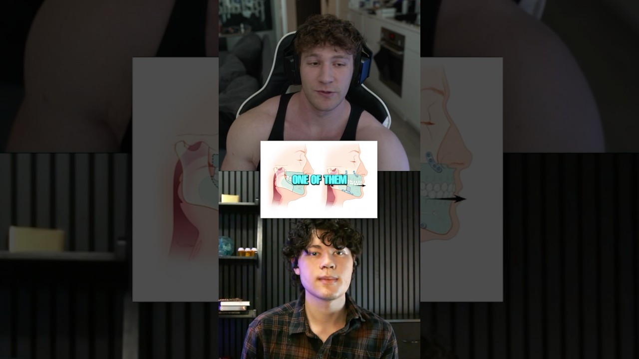 Looksmaxxer Spent a FORTUNE On Surgeries